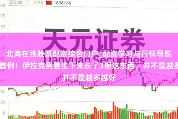 北海在线股票配资综合门户_配资学习与行情导航 环球首例！伊拉克男婴生下来长了3根这东西，并不是越多越好